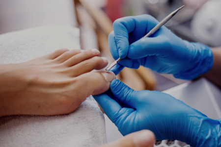 Nagelwal reinigen door pedicure Marjan Westerdijk